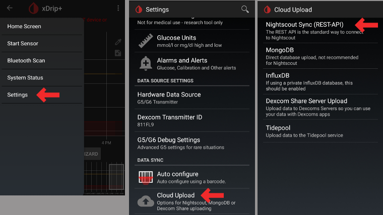 xDrip+ Basis Instellingen 1