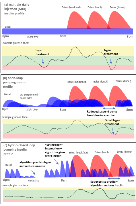 21-06-23 AAPS 血糖 MDI 等等